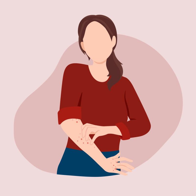 woman scratching a rash caused by scabies