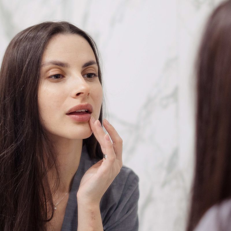 Woman looking at cold sore in a mirror