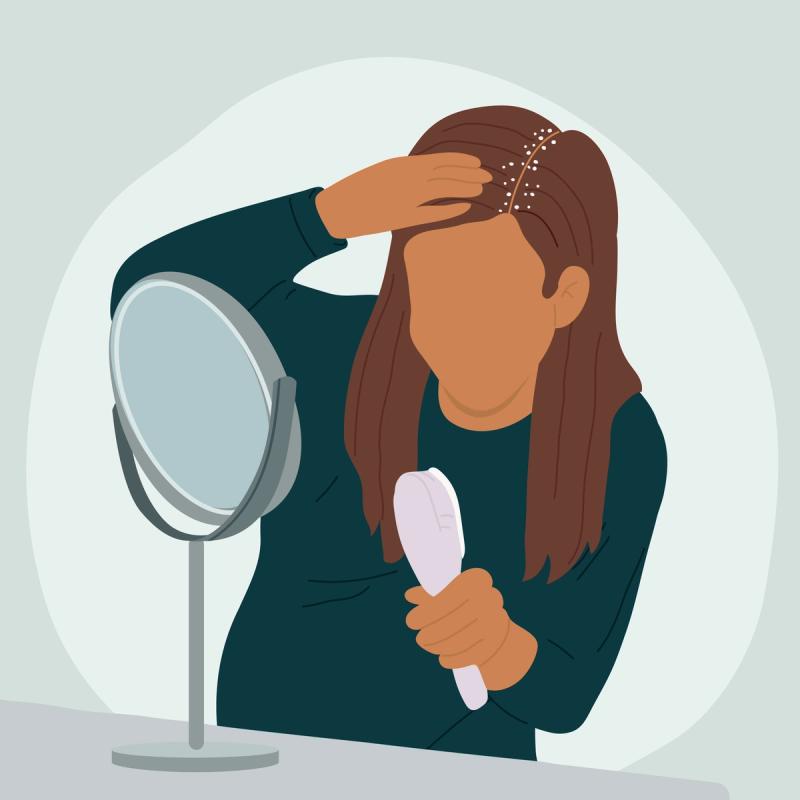 Illustration of a person affected by dandruff.