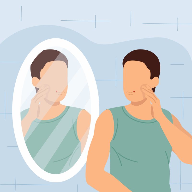 An illustration of a person affected by cold sores looking in a mirror