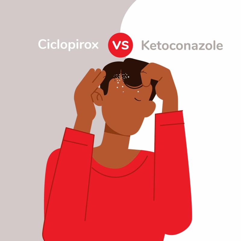 Illustration of Man Deciding Between Ciclopirox and Ketoconazole