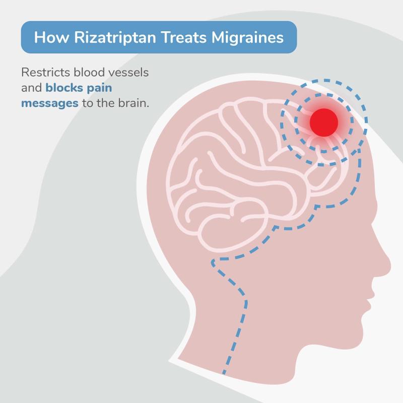 Illustration of Rizatriptan Treating a Migraine by Restricting Blood Vessels and Blocking Pain Messages in the Brain