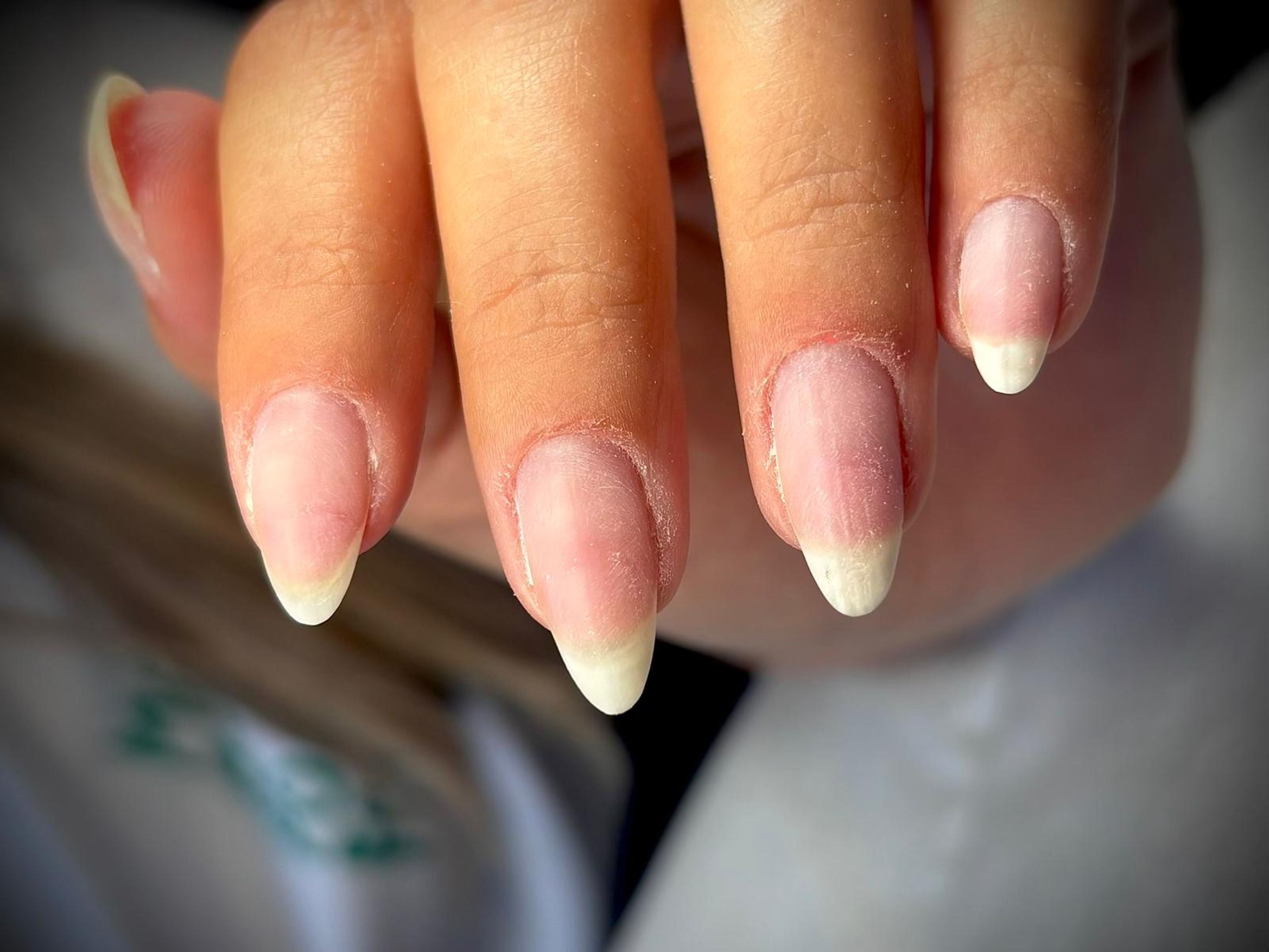 Une main aux ongles nus après une dépose Calgel® : la surface est lisse, sans stries ni zones blanchies.