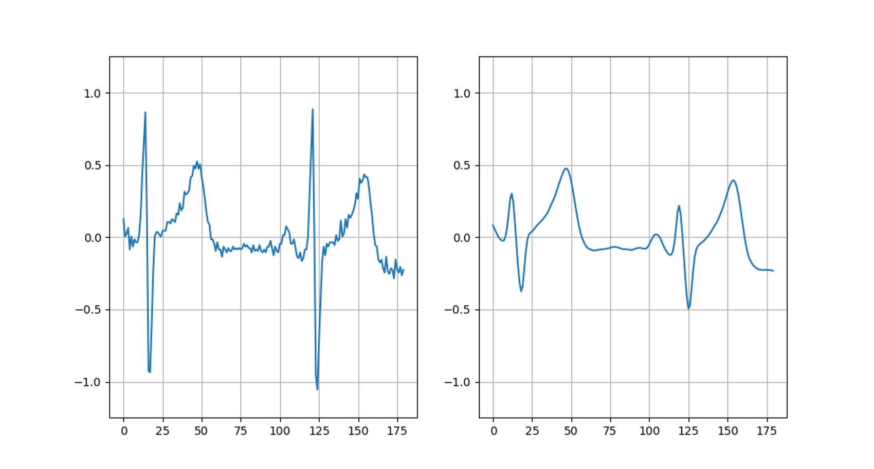 ECG waveforms before and after smoothing