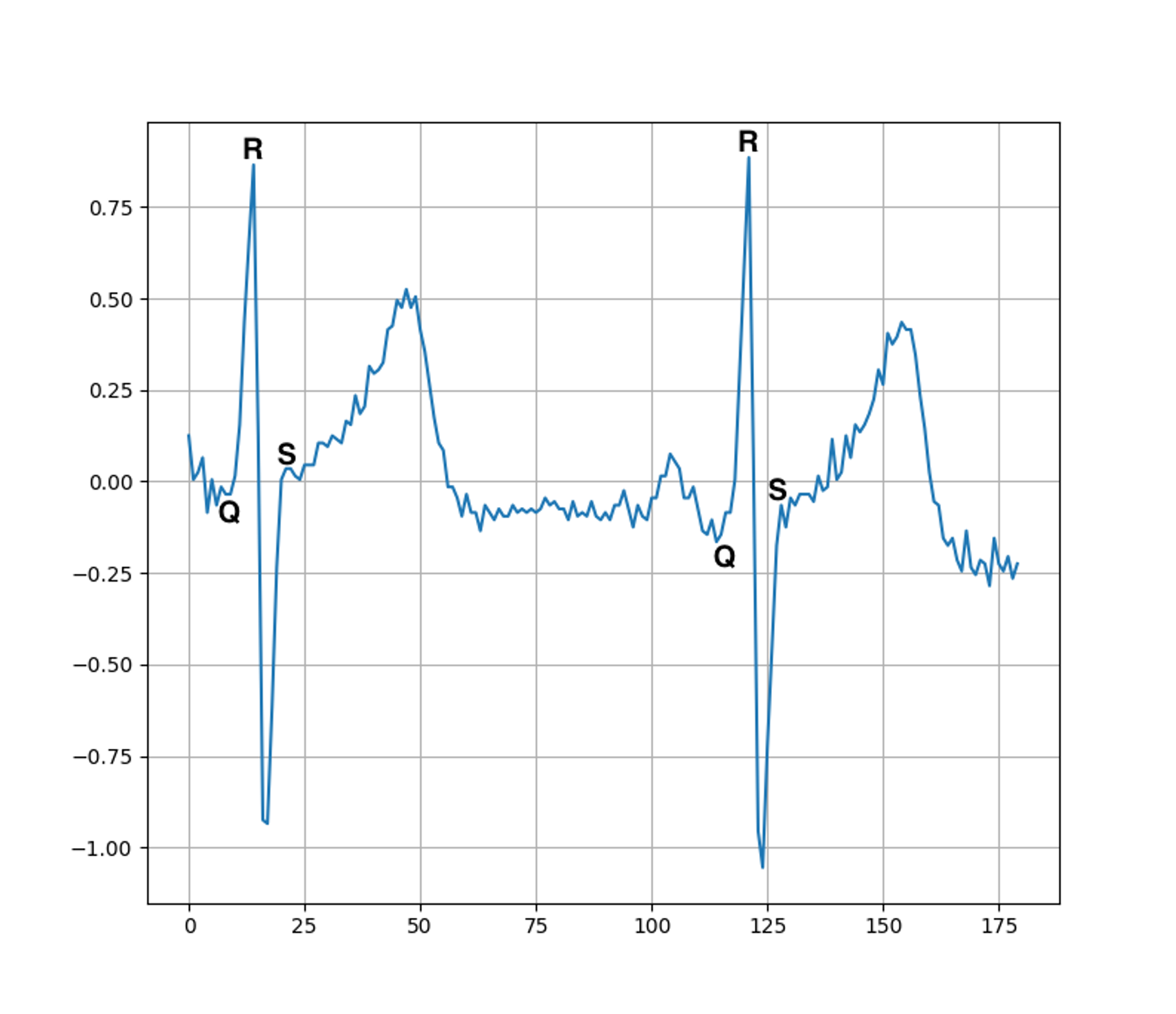 ECG waveform with QRS complex annotations