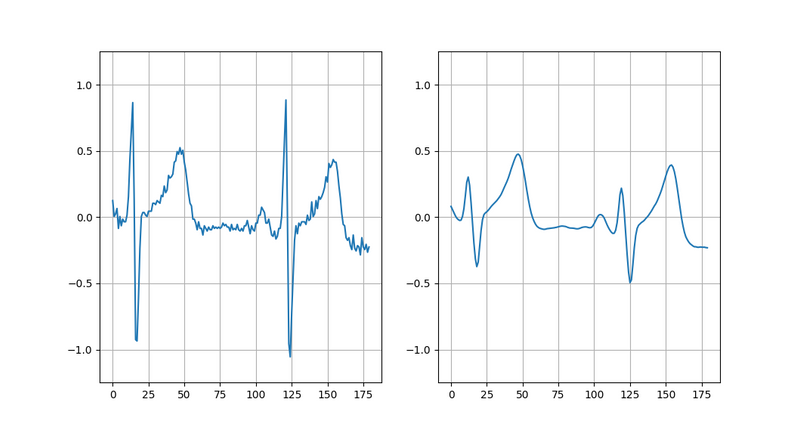 ECG waveforms before and after smoothing