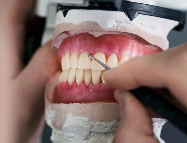 Próteses dentárias
