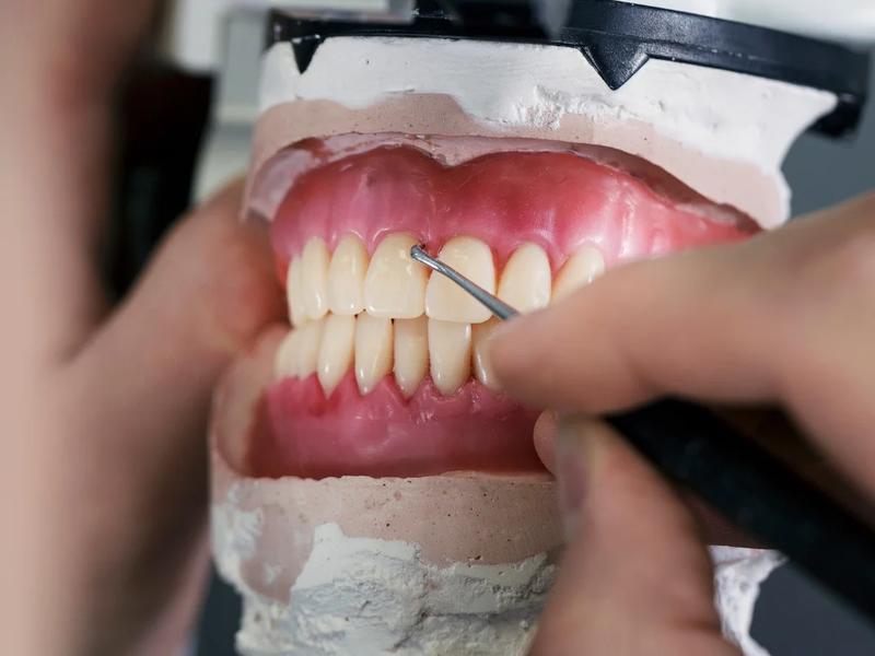 Próteses dentárias
