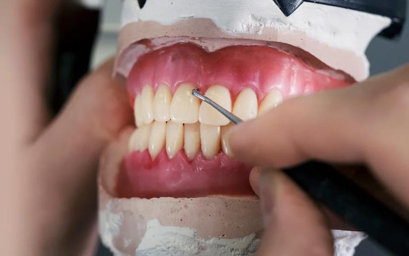 Próteses dentárias: recupere a mastigação, a fala e o sorriso