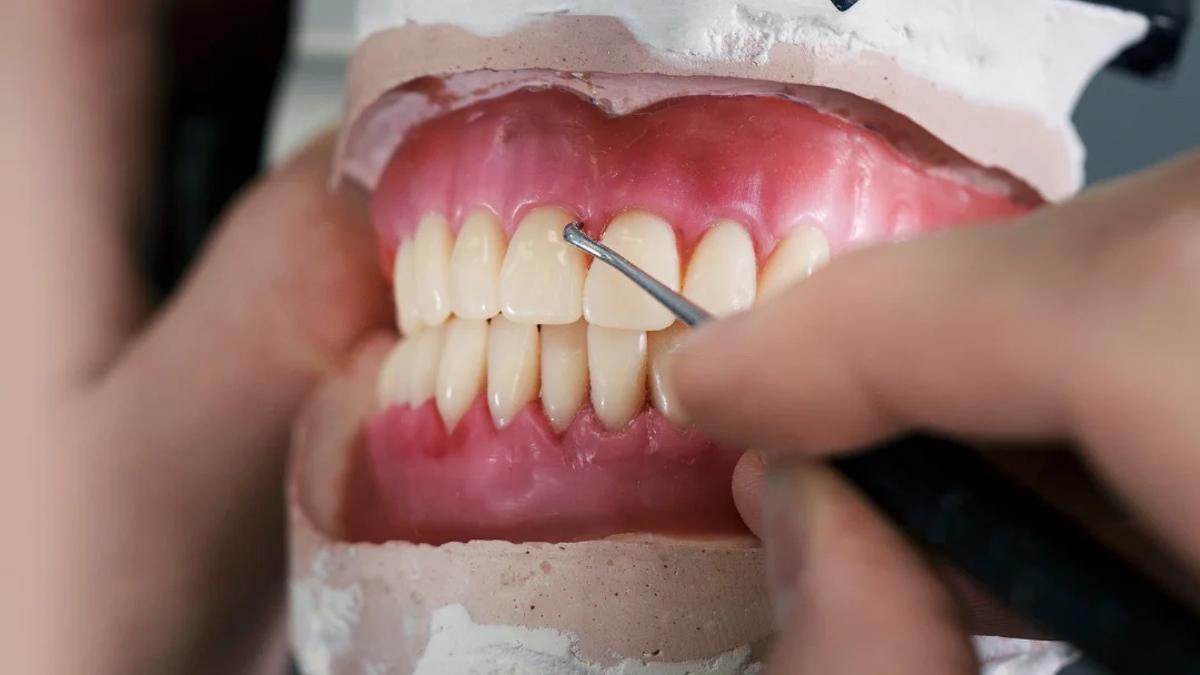 Próteses dentárias: recupere a mastigação, a fala e o sorriso