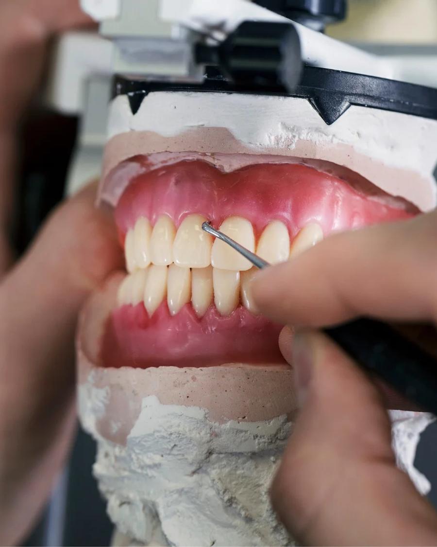 Próteses dentárias