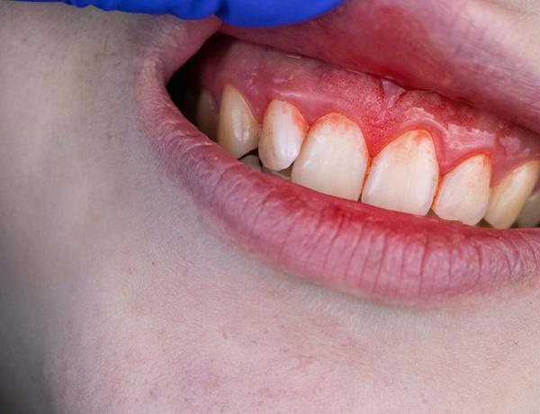 Periodontia