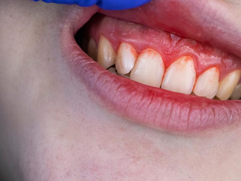 Periodontia