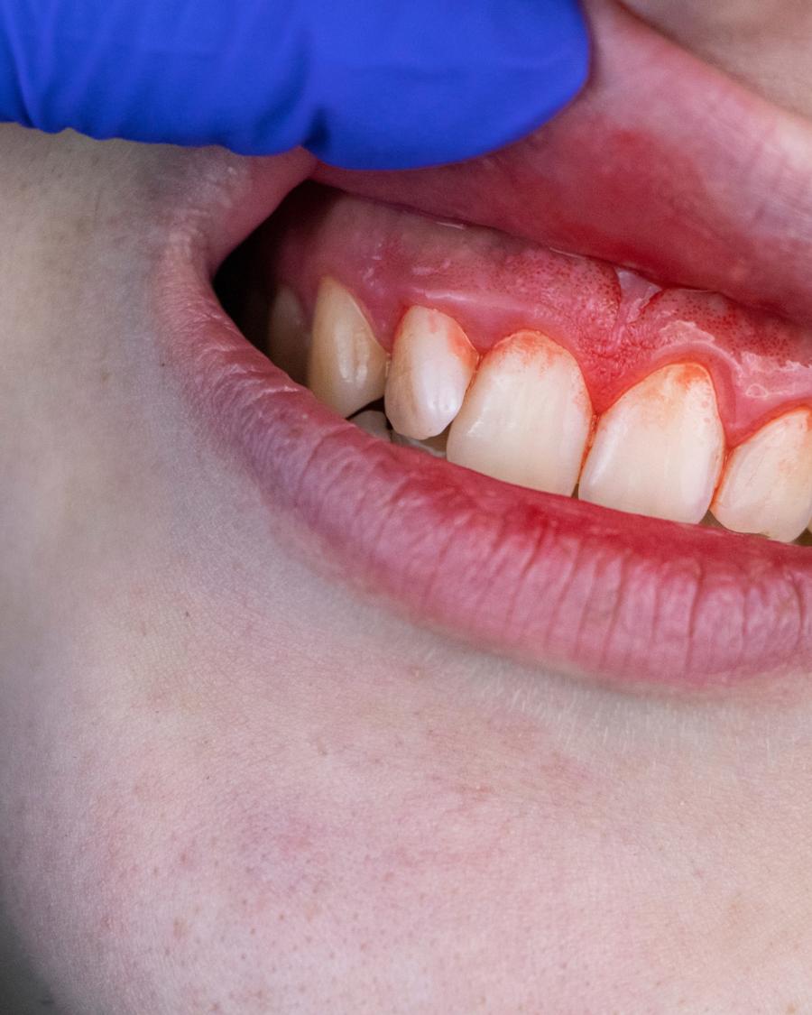Periodontia
