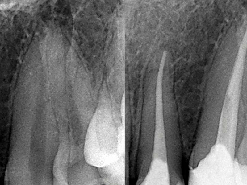 Endodontia