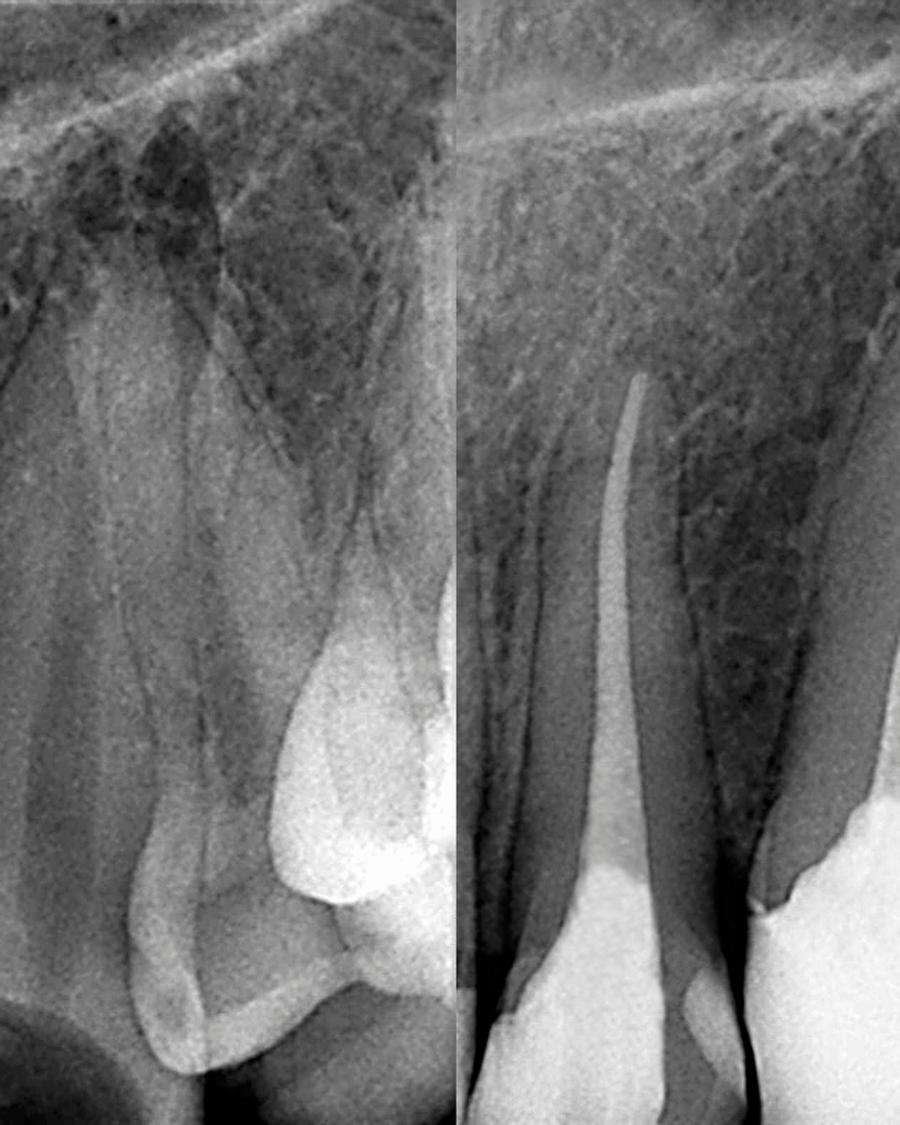 Endodontia