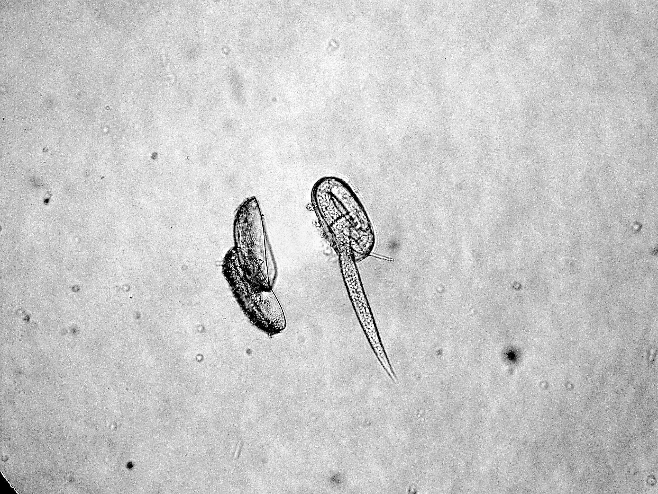Nematodes as Soil Health Indicators: What Can a Test Tell You?