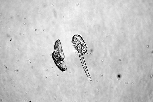 Nematodes as Soil Health Indicators: What Can a Test Tell You?