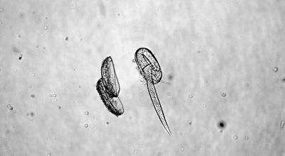 Nematodes as Soil Health Indicators: What Can a Test Tell You?