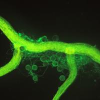 Microscope image of round arbuscular mycorrhizal fungal spores and threadlike hyphae growing on a corn root.