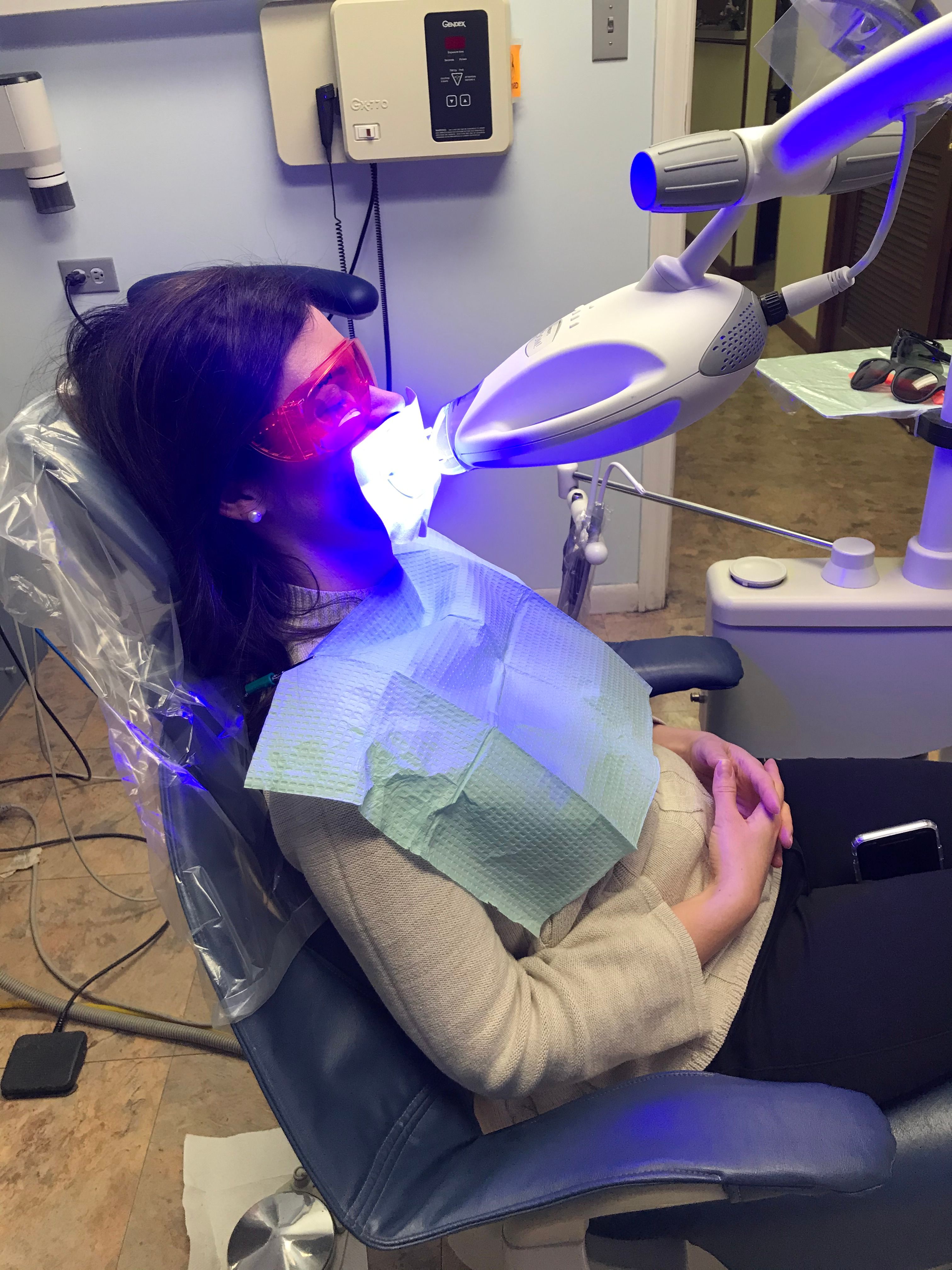 Zoom whitening lamp positioned over a patient's mouth during an in-office whitening treatment