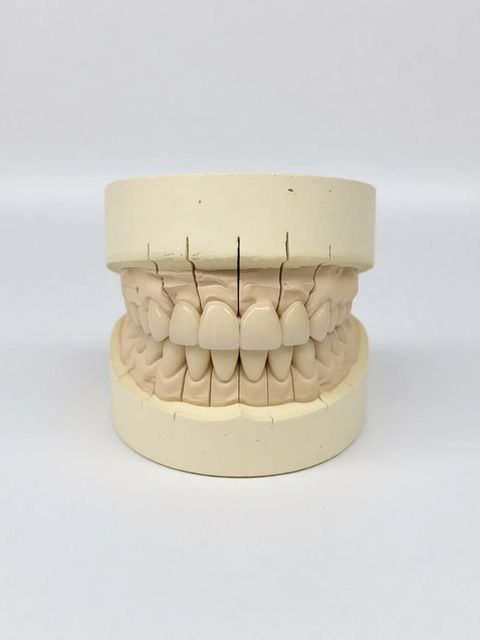 Dental Crowns
