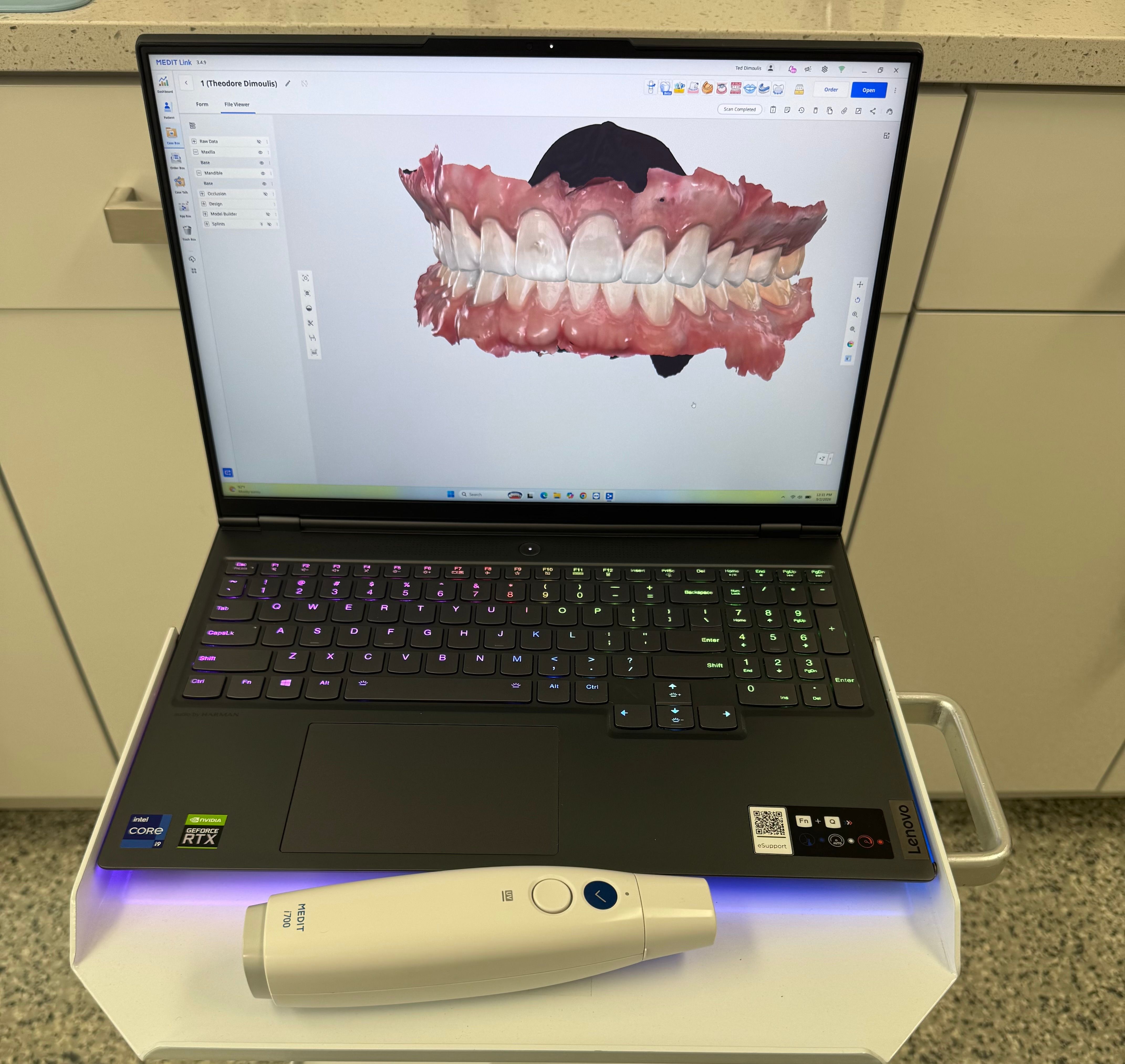 Dental Scanner and Laptop
