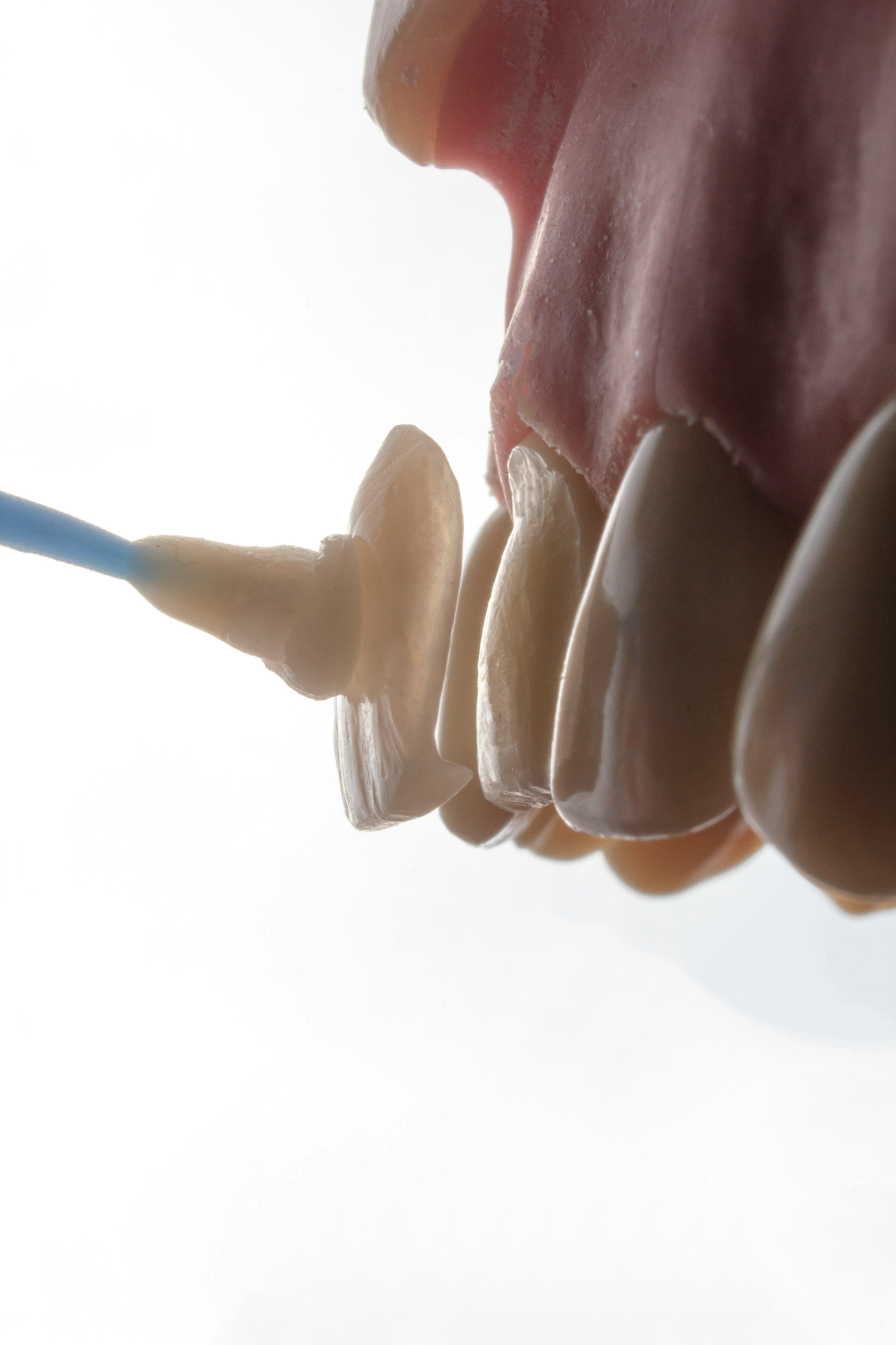 Veneer going on tooth