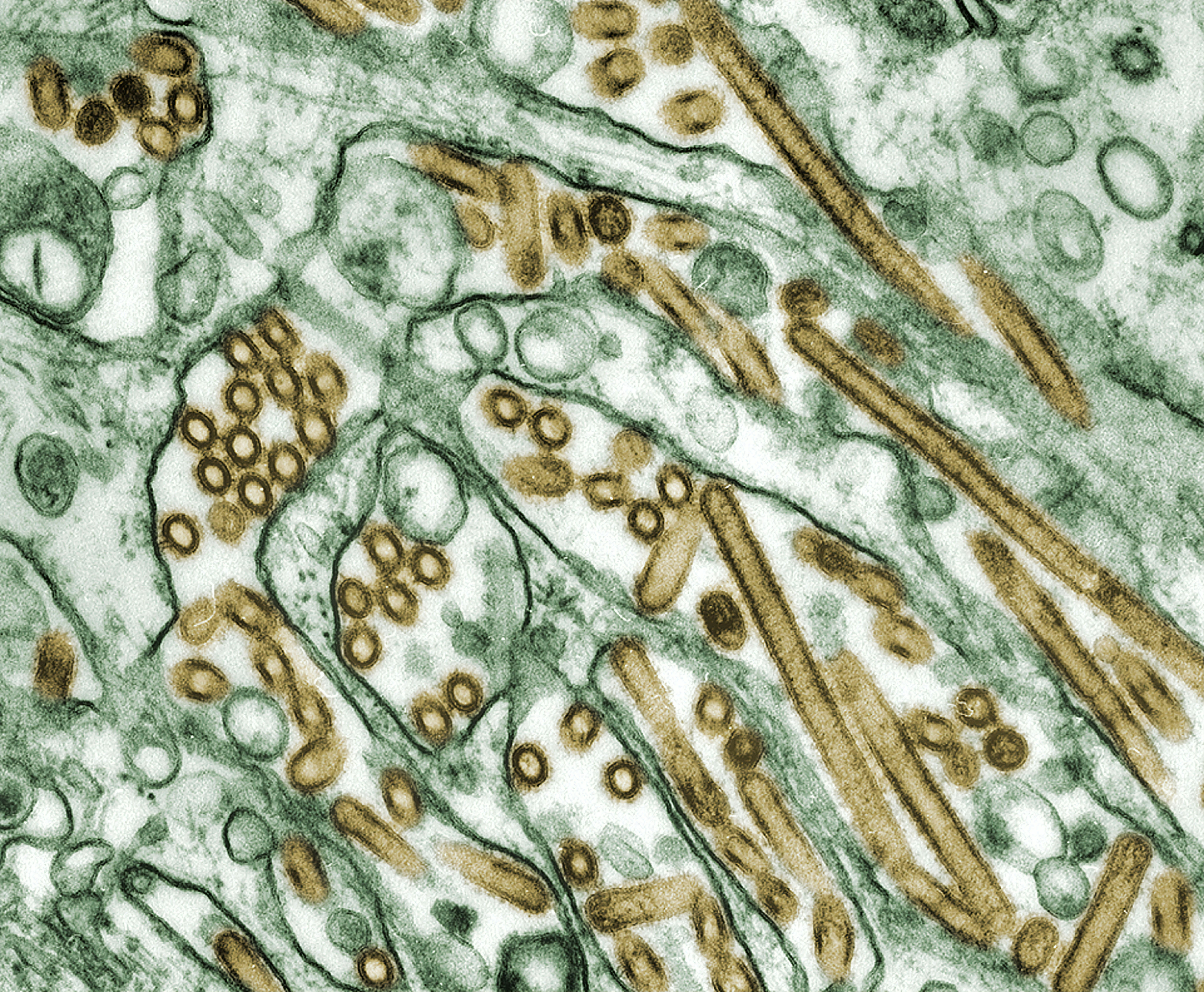 Consulta médica sobre el efecto del estrés en la inflamación intestinal en Mallorca