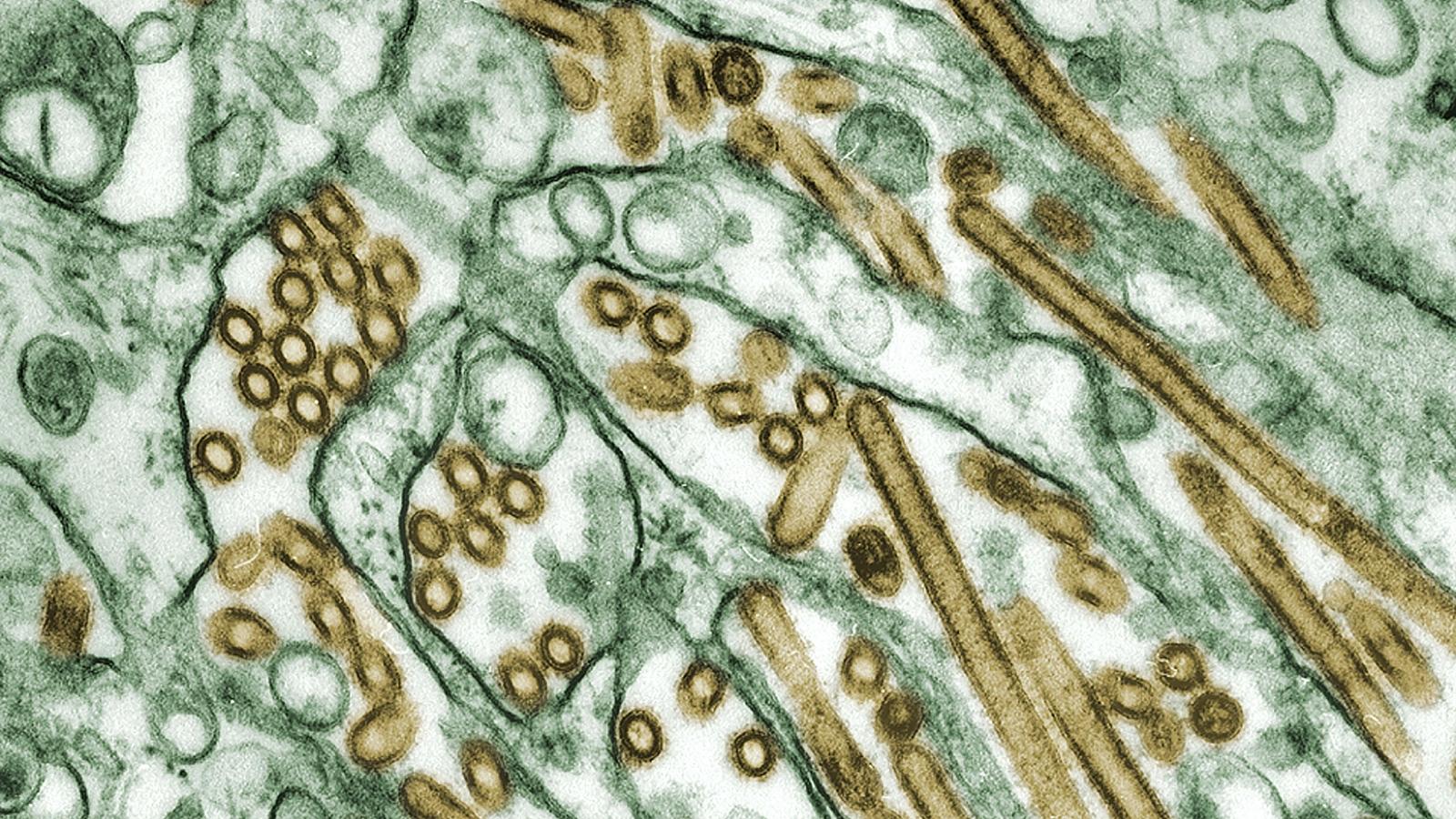 Consulta médica sobre el efecto del estrés en la inflamación intestinal en Mallorca