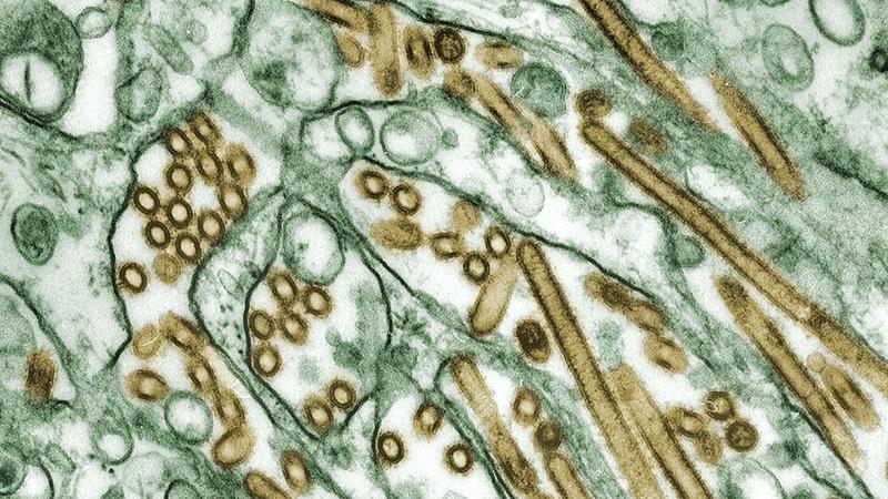 Consulta médica sobre el efecto del estrés en la inflamación intestinal en Mallorca