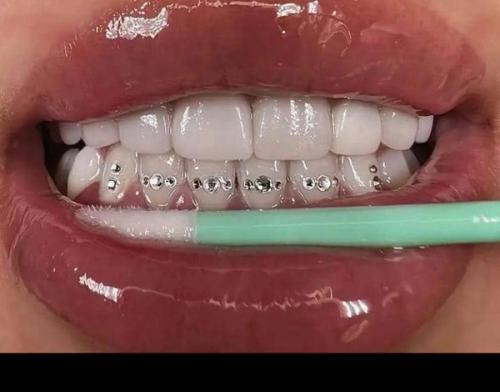 Teeth Rhinestone Gemstones.