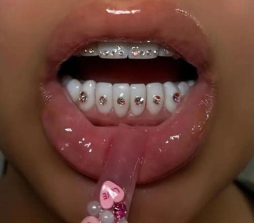 DIY Teeth Aurora Set.