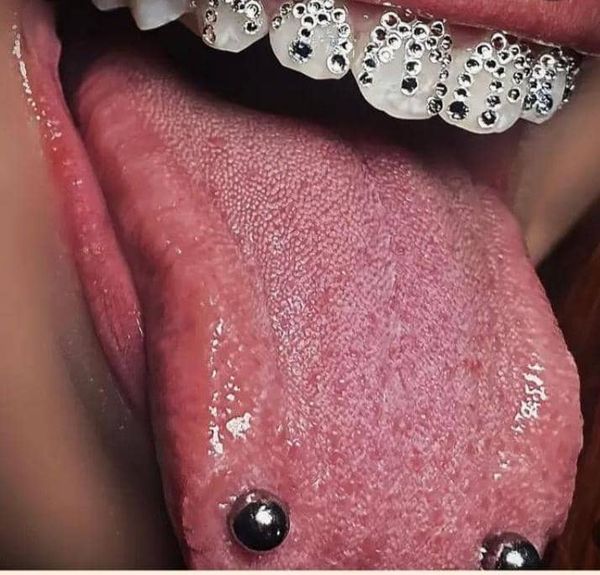 Tooth Gem Sparkling Set.