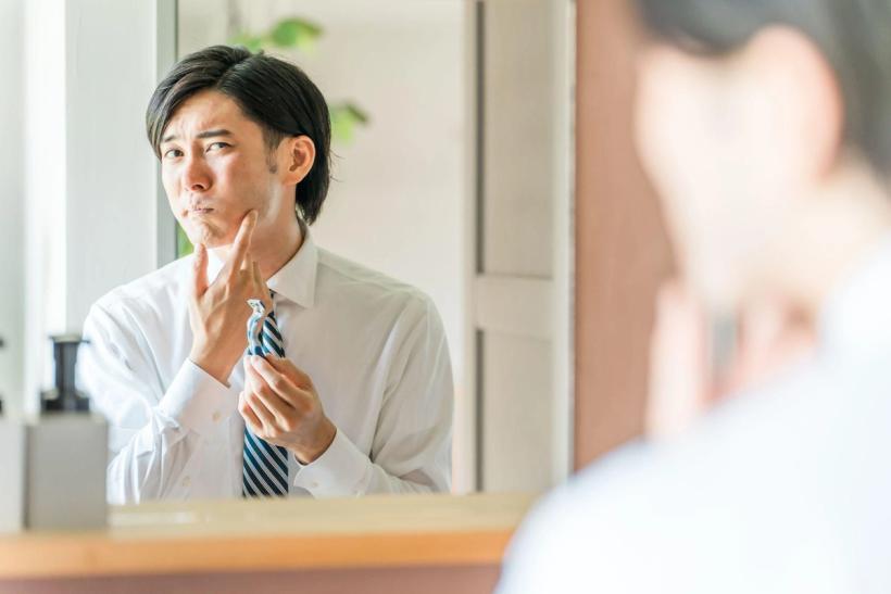 Asian man with razor bumps after a shave