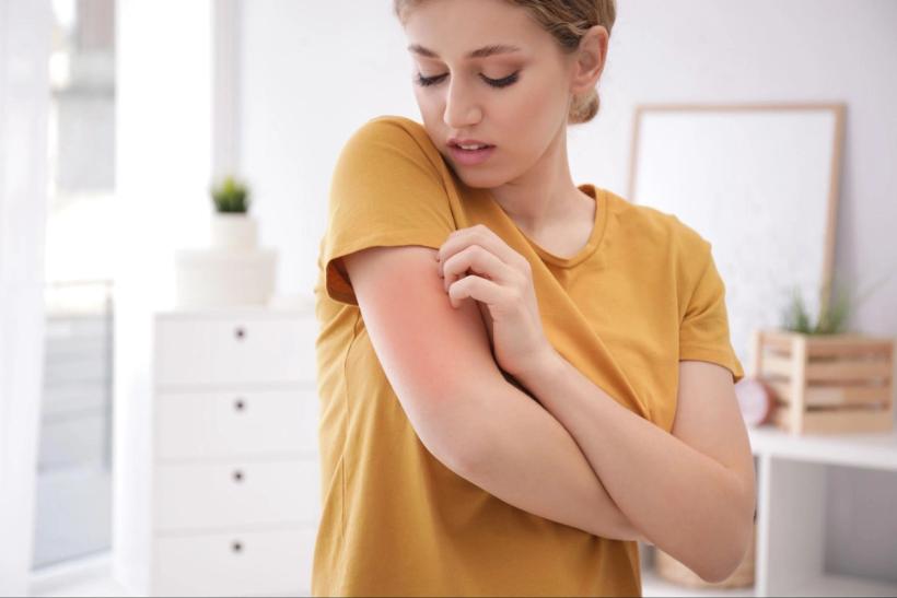 A woman scratching a red itchy rash