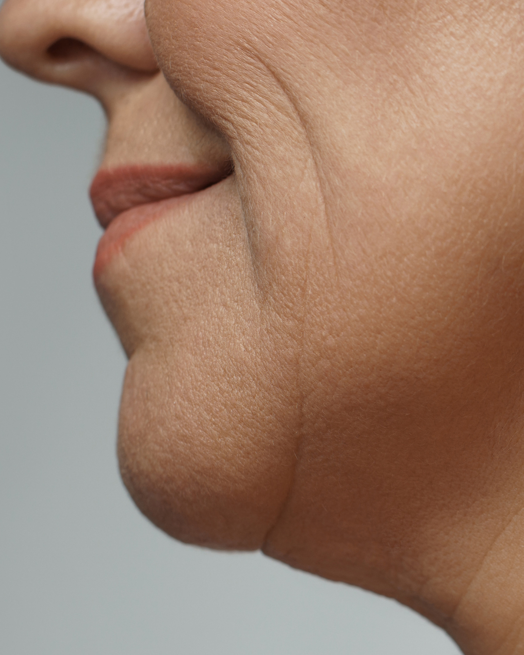 Beyond Volume: How Injectable Treatments Are Evolving
