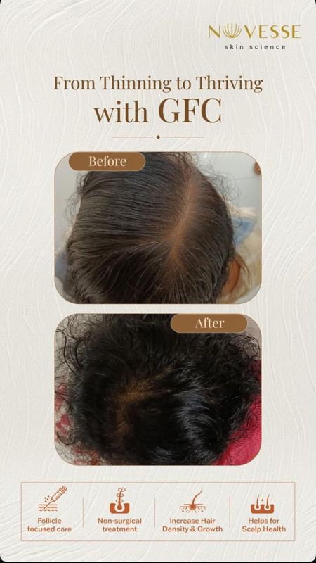 Signature Follicle Renew