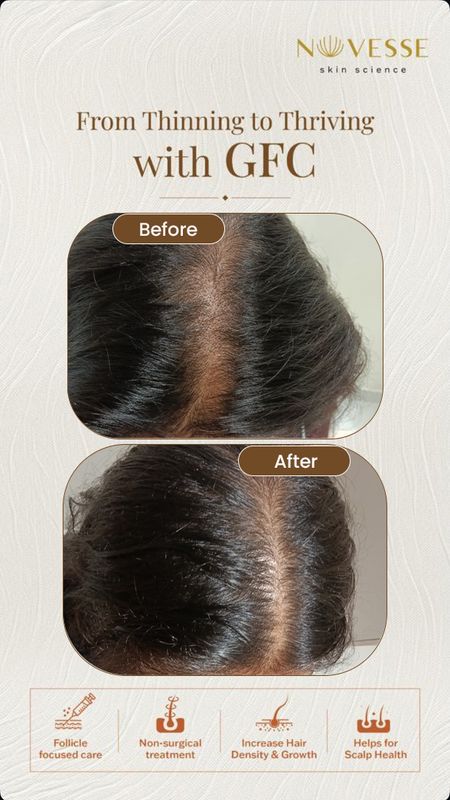 Signature Follicle Renew