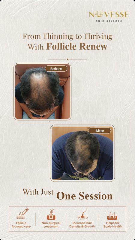 Signature Follicle Renew