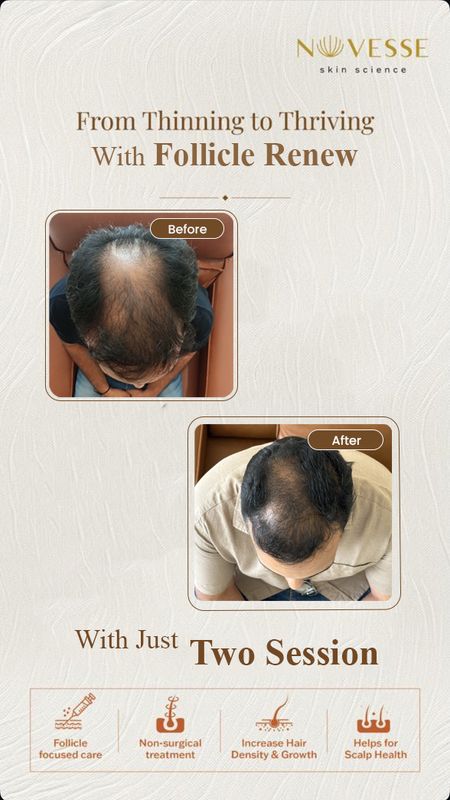 Signature Follicle Renew