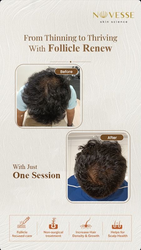 Signature Follicle Renew