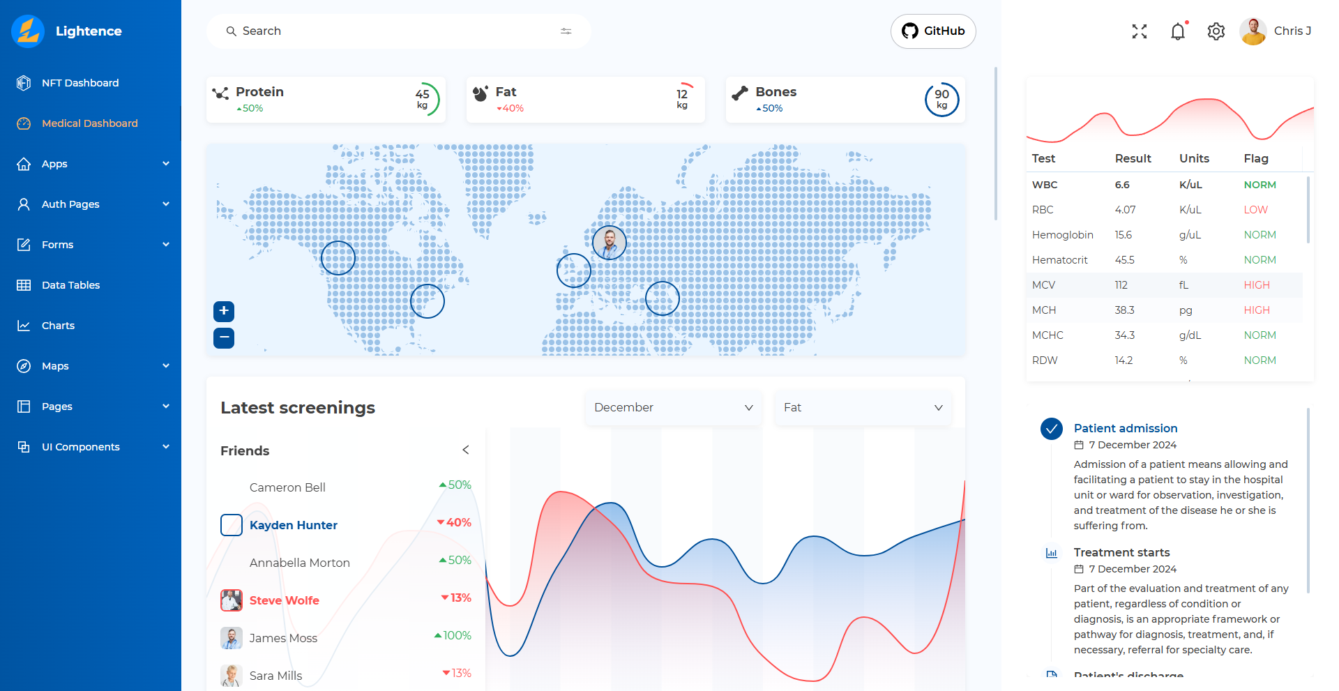 Image for Lightence(dashboard react template) on template0.com