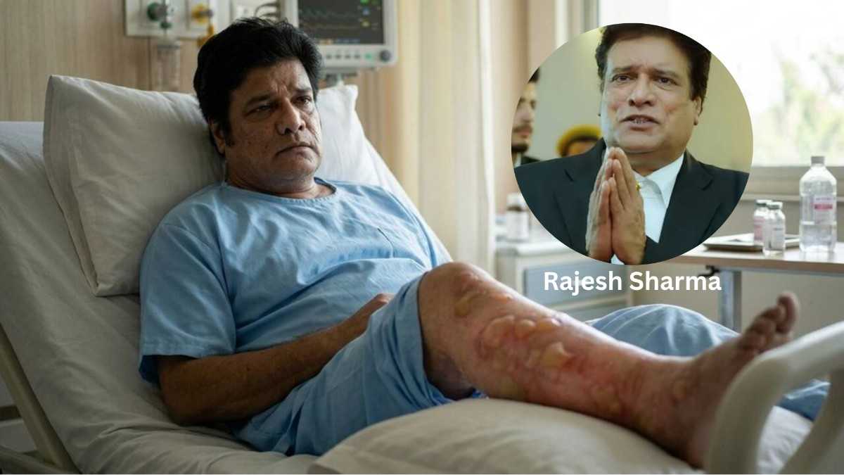 Prabhas Film Shooting Rajesh Sharma Health News