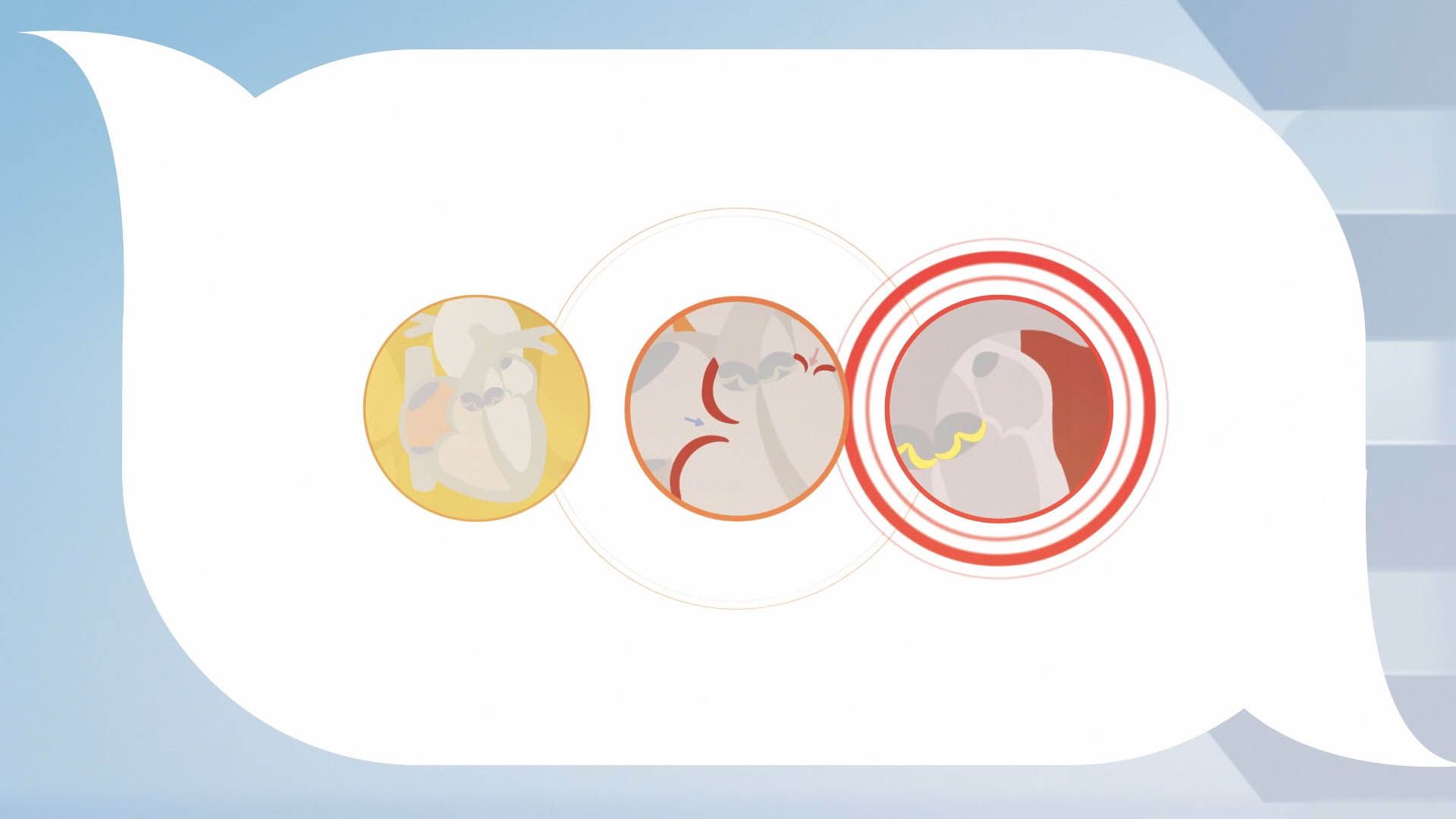Understanding Ultrasounds — frame 8