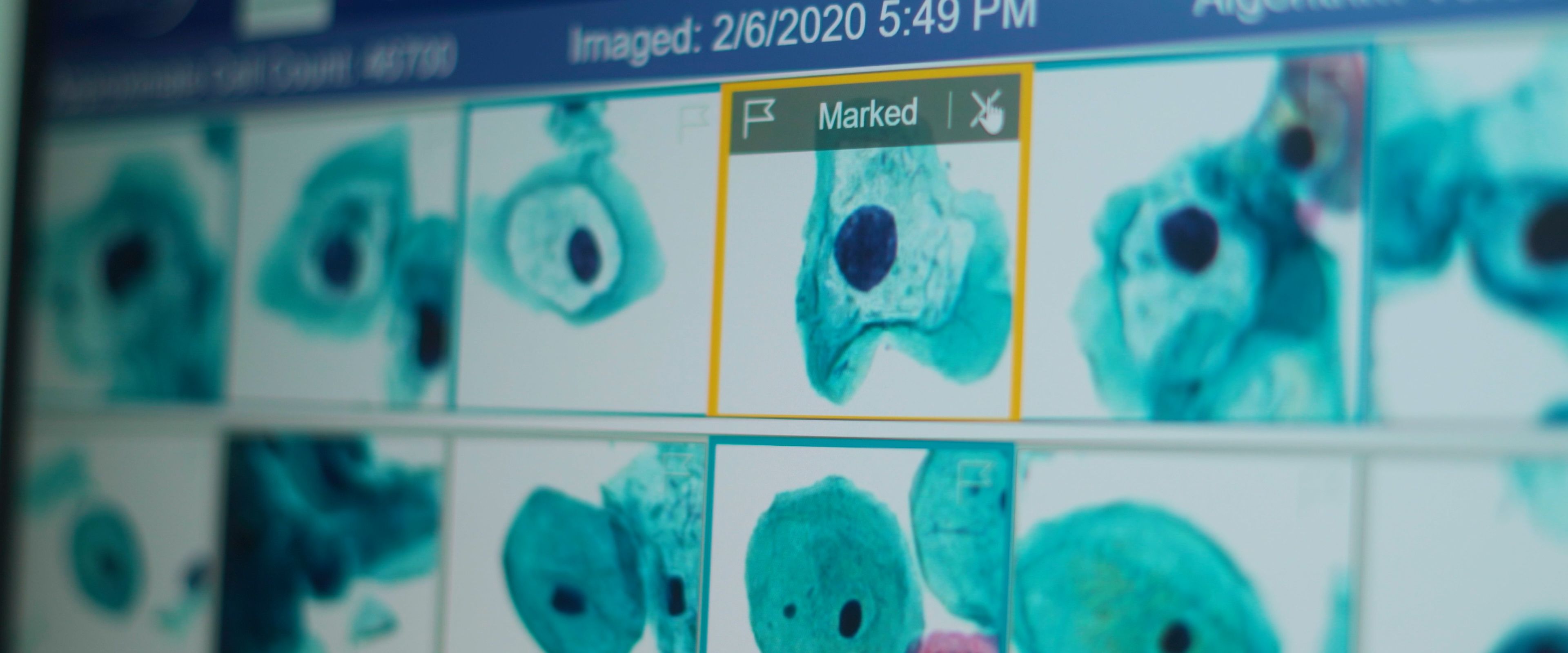 Genius® Vision Video — frame 20