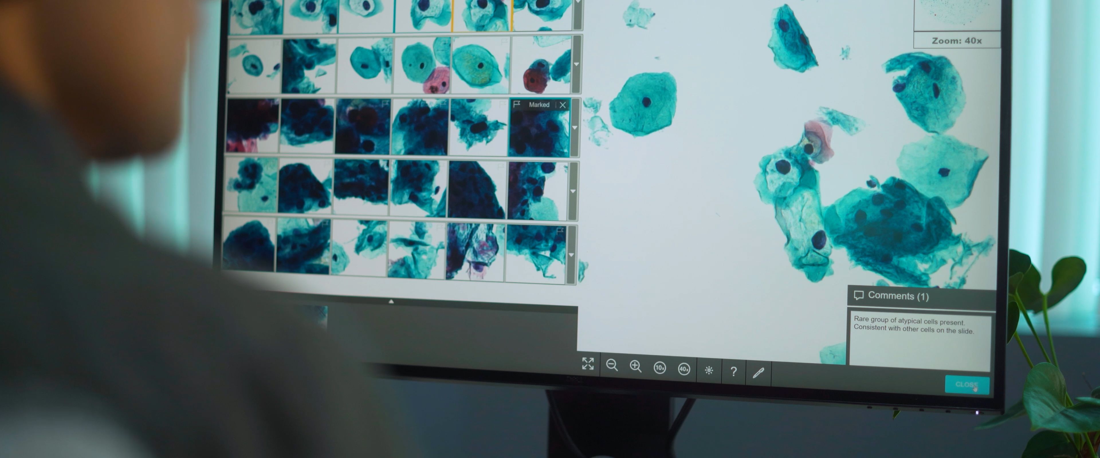 Genius® Vision Video — frame 21