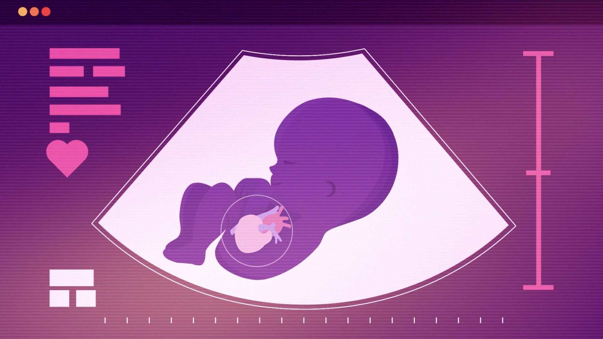 Understanding Ultrasounds — frame 5