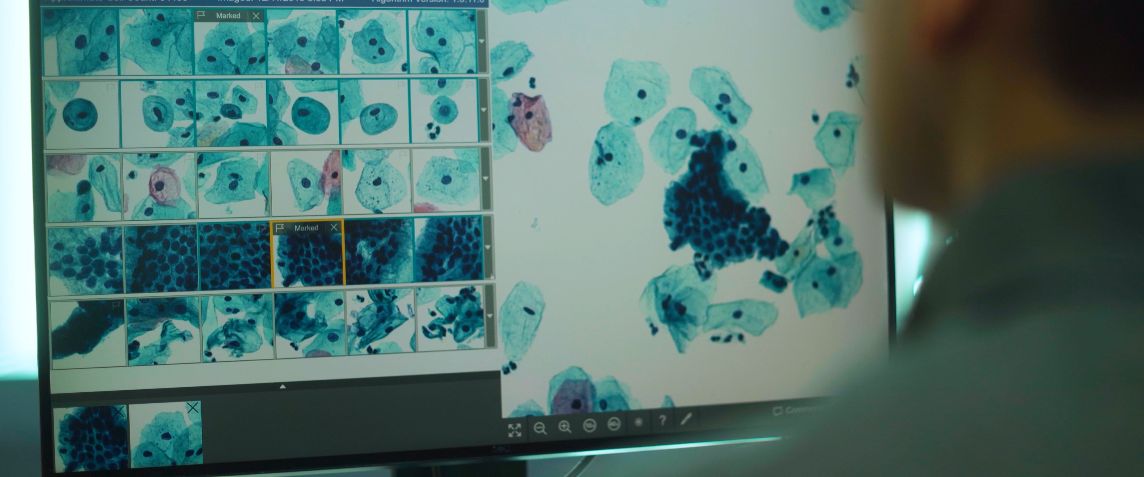 Genius® Vision Video — frame 17