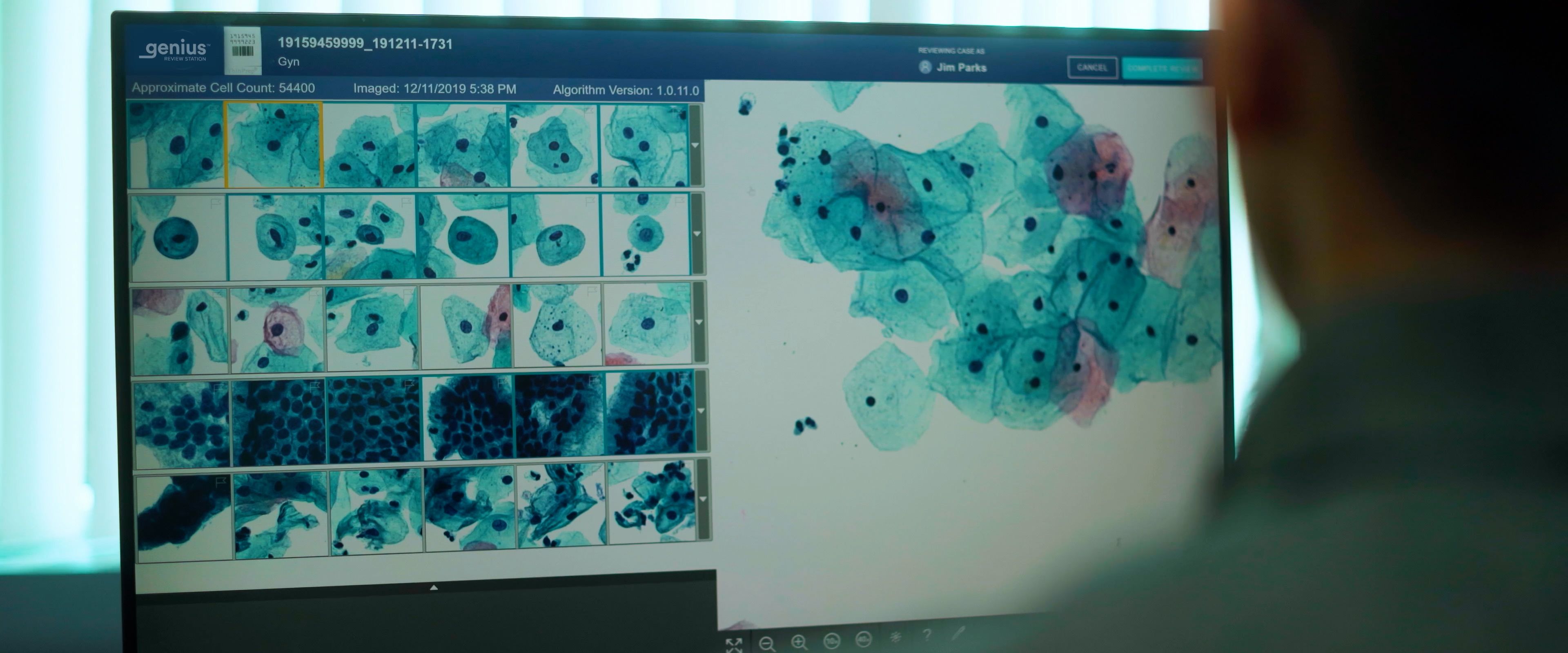 Genius® Vision Video — frame 14